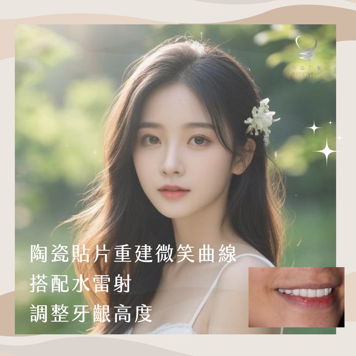 御森_陶瓷貼片1