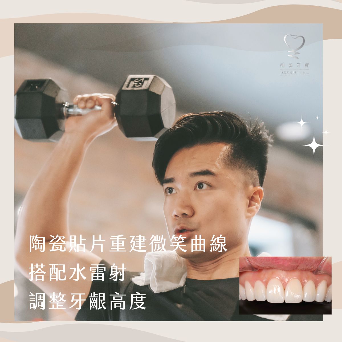 御森_陶瓷貼片2