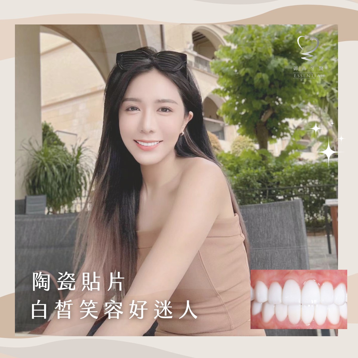 御森_陶瓷貼片3