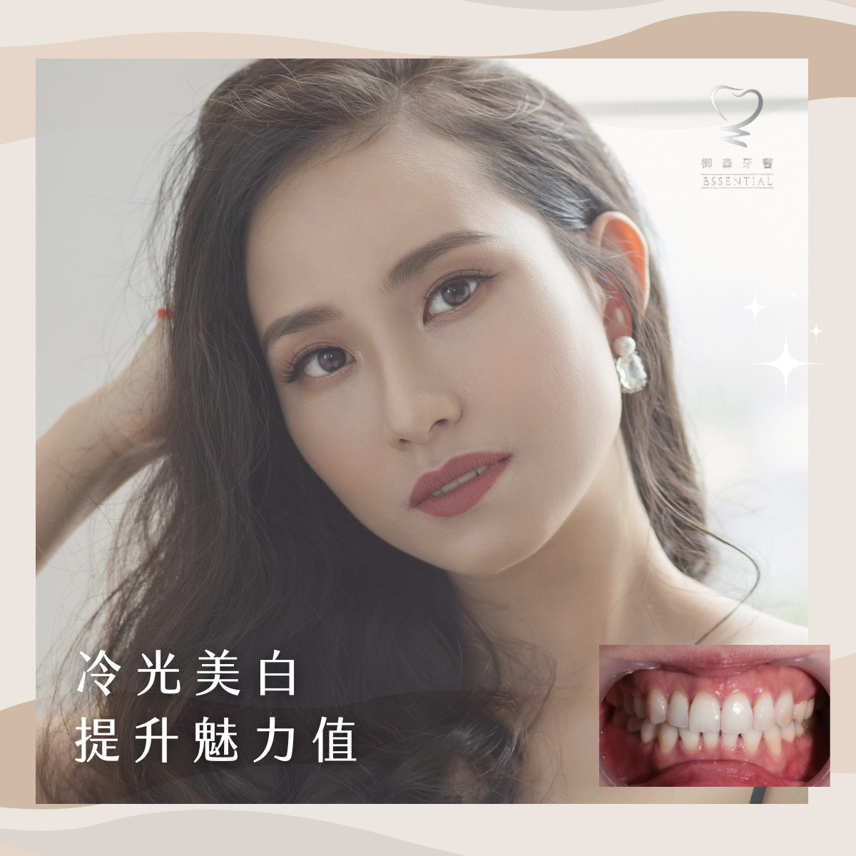 御森_陶瓷貼片4